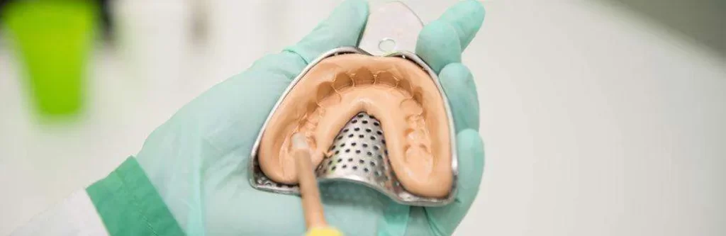 قالب گیری دندان برای ایمپلنت