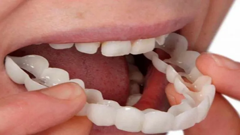 برخی دیگر از انواع کامپوزیتهای پر کردن دندان